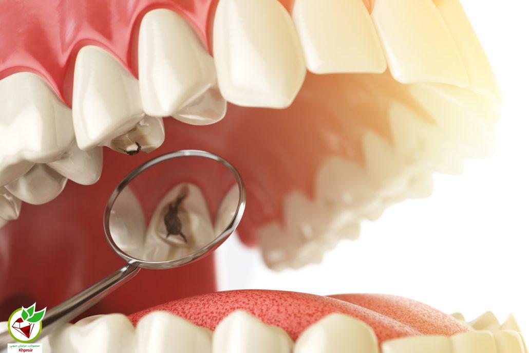 عوامل ایجاد کننده ی پوسیدگی دندانی